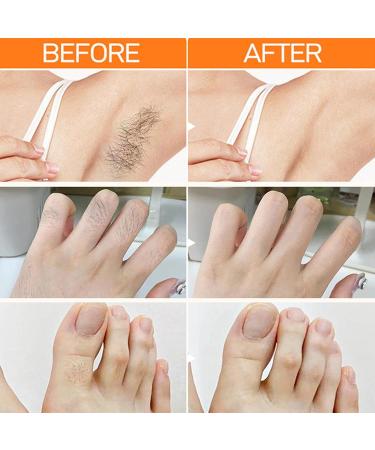 Facial hair removal cream | Effective and painless hair removal cream Body hair removal cream for lips eyebrows cheeks or bikini line sensitive skin - Buy Online on GoSupps.com