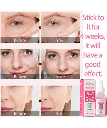 Vitamin C Serum For Face with Hyaluronic Acid Serum - Skincare with Vitamin E & Niacinamide for Anti-wrinkle & Fine Lines - Dark Spot Remover for Face - Anti Aging Serum for Improve Dull Tired Skin - Buy Online on GoSupps.com