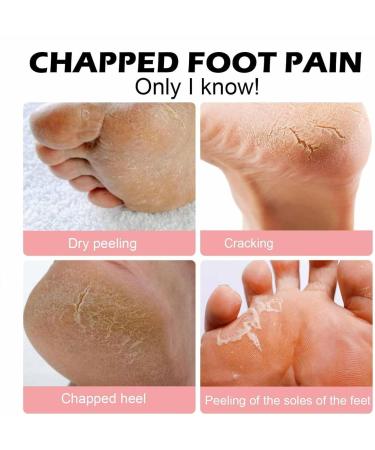  G n rique Foot Balm Anti-Drying Heel Cream Natural Moisturizing Formula Cracked Skin Repair Soothing Nourishment Care 40g Tube for Men Women Elbows Knees and More - Buy Online on GoSupps.com