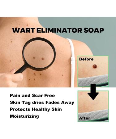 (100% Effective) 2PCS SmoothSkin Soap | Natural Aloe Vera Soap | Natural Smoothskin Soap | Moisturizing Instant Blemish Soap for All Skin Type | 100g/3.52fl.oz - Buy Online on GoSupps.com