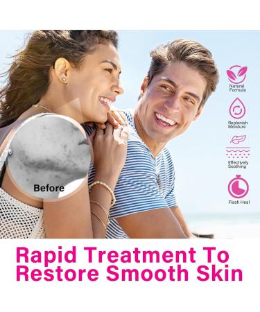 SCOBUTY Azelaic Acid Face Serum Cream Brightening Face Skin Care Treatment and Repair Dark Spots for All Skin Types 20ml 20 g (Pack of 1) - Buy Online on GoSupps.com