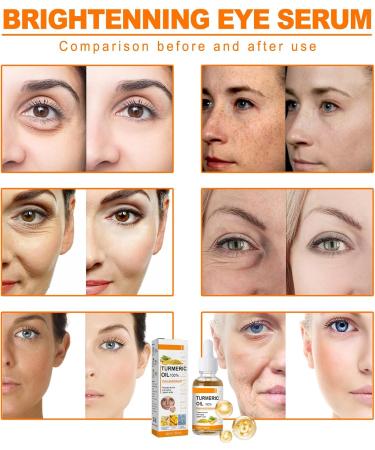 Turmeric Oil Facial Serum Turmeric Spot Correcting Serum & Illuminating Serum improves dullness diminishes spots improves skin tone moisturises and illuminates suitable for all skin type (10ML) - Buy Online on GoSupps.com