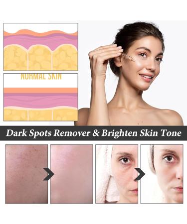Hyaluronic Acid 2% + B5 30ML Hyaluronic Acid Serum for Face Dark Spot Remover for Face Hyaluronic Acid Face Moisturize Skincare Serum for Face to Plump and Smooth Skin for All Skin Types Skin Care - Buy Online on GoSupps.com