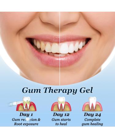 Neslemy Gum Gel Neslemy Gum Shield Therapy-Gel Teeth Whitening Gums Instant Soothing Gels Dentizen Gum- TherapyGel Instant Tooth Whitening Pens for Oral Care (3PCS) - Buy Online on GoSupps.com