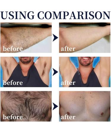 Men Hair Removal cream Spray Natural Permanent Hair Removal Spray for Face Underarm Arm Leg Non-Irritating Depilatories Product - Buy Online on GoSupps.com