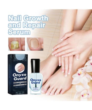 Onyxoguard Nail Growth & Repair Serum | Strengthen Brittle Nails | 5PC Onycholysisheal Conditioner - Buy Online on GoSupps.com