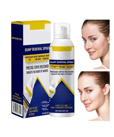 Monozoz Moisturizer for Dry Skin 60 ml Soothing and Repairing Solution Mist | Soothing Skin Spray for Men and Women for Blemishes Back Shoulders Arms Legs Hands