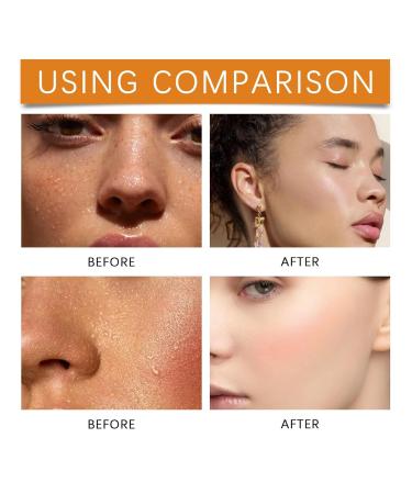 Face Antiperspirant Sweat Absorbing Lotion Face Anti Sweat Lotion Face Sweat Blocker Antiperspirant and Oil Control Lotion for Face Forehead and Scalp Reduces Face and Body Sweating - Buy Online on GoSupps.com