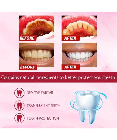 Verdant Touch Probiotic Whitening Cleaning Toothpaste 2 Pack 120ml Freshens Breath Removes Tartar Stain Dental Cleaning - Buy Online on GoSupps.com