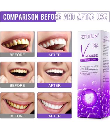 Teeth Whitening Mousse - Purple Foam Toothpaste for Stain Removal & Whitening Booster - Buy Online on GoSupps.com