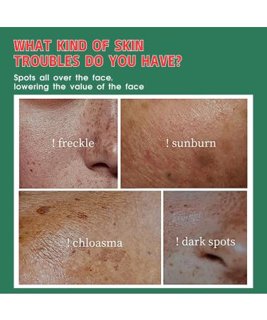 Dark Spot Remover for Face Body Dark Spot Corrector Age Spot Remover for Face Spot Cream with Niacinamide Vitamin C Reduces Hyperpigmentation Sun Spot Remover Blemish Freckle Reducer - Buy Online on GoSupps.com