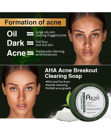 AILKE BOOST LUSTER AILKE AHA Acne Breakout Clearing Soap Bar Deep Clean Skin Unclog Pores Brightening with Lavender Essential Oil Reduces Pimples Blackheads 150 g Pack of 1 1 copy - Buy Online on GoSupps.com