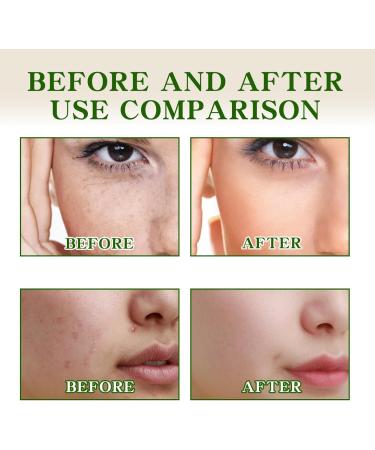 Green Orange Dark Spot Correcting Glow Serum - Women's Vitamin C Serum - Fade Acne Marks - Lasting Moisturizing - Anti-aging Facial Serum 30ml - Buy Online on GoSupps.com