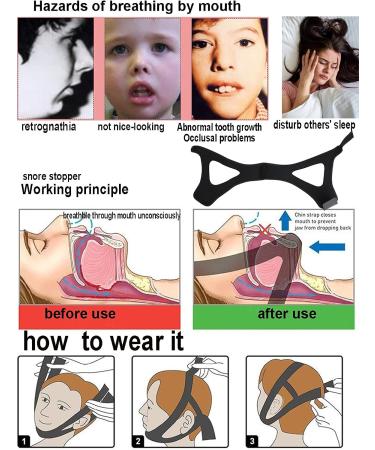 IBLUELOVER Anti Snoring Chin Strap - Breathable Adjustable Snoring Solution for Men, Women, CPAP Users - Buy Online on GoSupps.com