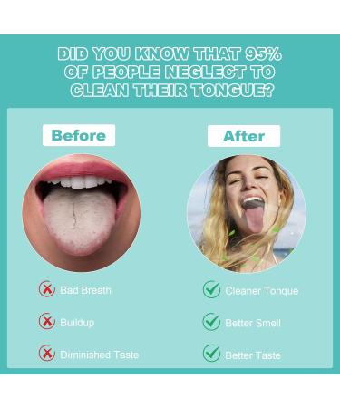 Stainless Steel Tongue Cleaner Set - 2 Pieces for Fresh Breath & Oral Hygiene | Reduces Bad Breath for Adults & Kids - Buy Online on GoSupps.com