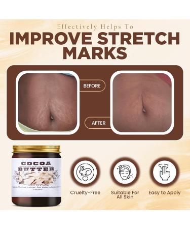 Cocoa Butter for Skin Care - Moisturizing & Nourishing | 1 Ounce | International Shipping - Buy Online on GoSupps.com