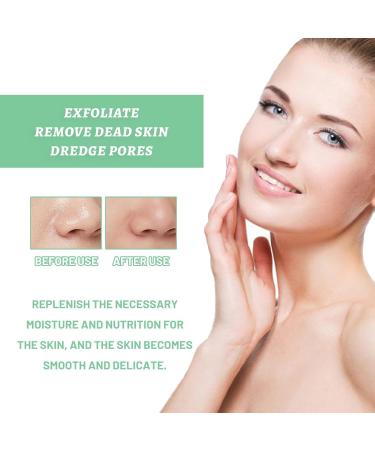 She Eureka Exfoliating Gel She Eureka Exfoliating Gel She Eureka Peeling Gel Herbal Extract Exfoliating Gel Exfoliating Body Scrub (1PC) - Buy Online on GoSupps.com