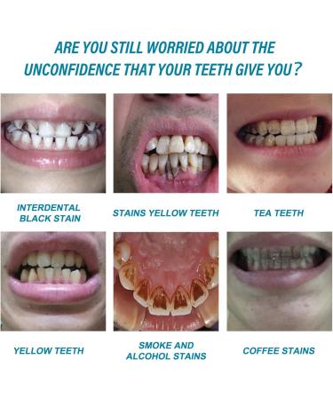 Teeth Whitening Serum for Oral Care - Removes Coffee, Wine, and Smoking Stains - 30ML - Buy Online on GoSupps.com
