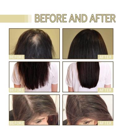 Veganic Natural Hair Growth Oil - Carvenchi Organic Rosemary Oil for Hair Growth Vegan Hair Oil for Dry and Damaged Hair Promotes Growth and Thickness - Buy Online on GoSupps.com