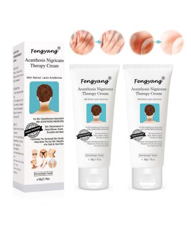 Fengyang® Acanthosis Nigricans Cream, Anti-Dark Spots Cream, Correcting Cream for Elbow, Knee Joint