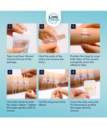 3.7 Zip Strips Wound Closure Device - 3CT First Aid Kit - Steri Strips for Cuts - Buy Online on GoSupps.com