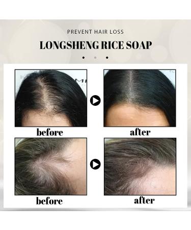 Handcrafted Rice Water & Aloe Vera Shampoo Bar for Hair Growth - 4.2oz - Buy Online on GoSupps.com