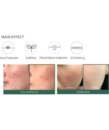 SOME BY MI AHA-BHA-PHA 30 DAYS MIRACLE ACNE CLEAR FOAM (100 ml)- Functional face cleanser - Buy Online on GoSupps.com
