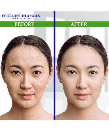 michael marcus Aloe Gentle Facial Cleanser Foaming with Honey & Rosemary Extract 4 fl oz - Refresh Moisture & Hydrating Facial Cleanser - Cruelty Free Paraben-Free & Fragrance Free Cleansing Foam Aloe Cleanser 4oz - Buy Online on GoSupps.com