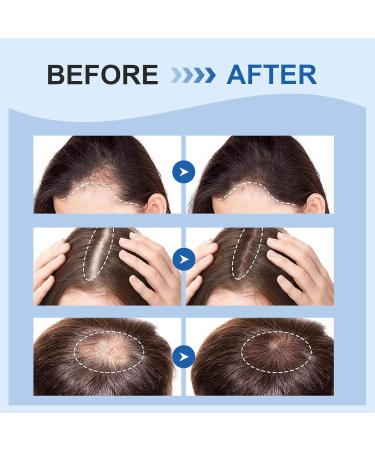  Waymaytecy 60ml Hair Growth Serum Hair Growth Oil for Women and Men Hair Treatment Scalp and Hair Strengthening Reduces Hair Loss - Buy Online on GoSupps.com