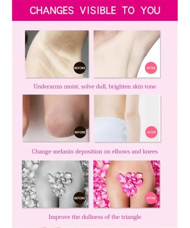 Underarm Whitening Cream Underarm Whitening Products Whitening Cream Skin Whitening Cream Skin Lightening Cream Whitening Cream For Underarm Knees & Elbows & Legs - Buy Online on GoSupps.com
