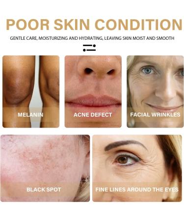 Turmeric Dark Spot Corrector Serum 2022 New Natural Turmeric Repair Face Serum Facial Moisturizing Essence Bright Skin Dark Spot Corrector Face Whitening Serum - Buy Online on GoSupps.com