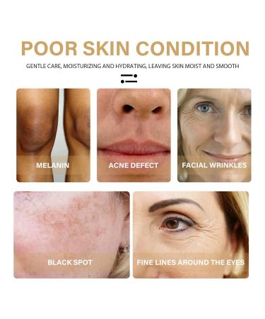 Turmeric Dark Spot Repair Facial Serum - 2Pcs 2022 Natural New Turmeric Essence for Dry Skin - 30ml (1 Fl Oz) - Buy Online on GoSupps.com