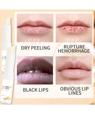 Lip Hyperpigmentation Treatment Lip Lightening For Dark Lips Lip Repair Cream For Dry Cracked Lips Lip Care Cream Lip Cream Dry Lip Wrinkle Cream Moisturizing Lip Care Cream Chapped Lips Treatment - Buy Online on GoSupps.com