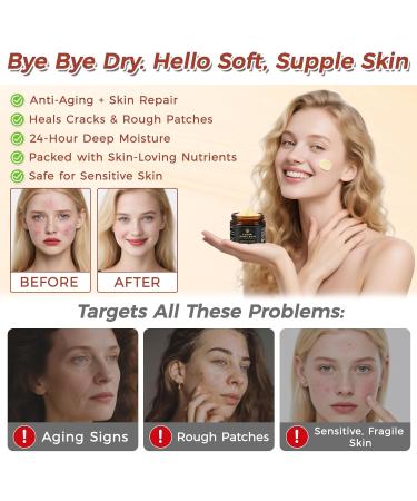 Beef Tallow for Skin Tallow and Honey Balm Organic Grass-Fed Beef Tallow Balm with Honey Face and Body Moisturizer(60g) 2.12 Ounce (Pack of 1) - Buy Online on GoSupps.com