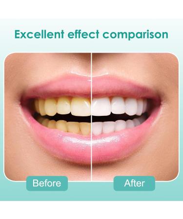 Natural Oral Care Oil - Coconut & Peppermint - 100ml Mouthwash for Fresh Breath Teeth Whitening & Gum Health - Buy Online on GoSupps.com