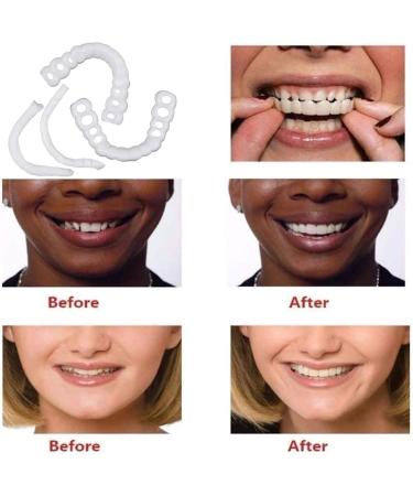 2 Pairs Adjustable Temporary Teeth - Nature-Friendly & Comfortable for a Confident Smile - International Shipping - Buy Online on GoSupps.com