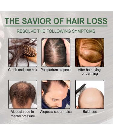 Hair Thickening Oil - Natural Oil for Dry Hair Hair Strengthening Oil Women Beauty Products for Home Business Trip Travel Puchen - Buy Online on GoSupps.com