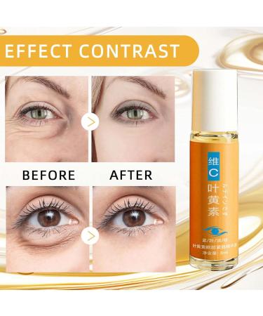 Luteine Eye Essence Oil Luteine Eye Oil Luteine Huile Essentielle De Lut ine VC Pour Les Yeux Huile Essentielle De Lut ine Pour Les Yeux Pour Att nuer Les Poches Sous Les Yeux Et Les Cernes (8ml 5PC) 5PC 8 ml (Lot de 1) - Buy Online on GoSupps.com