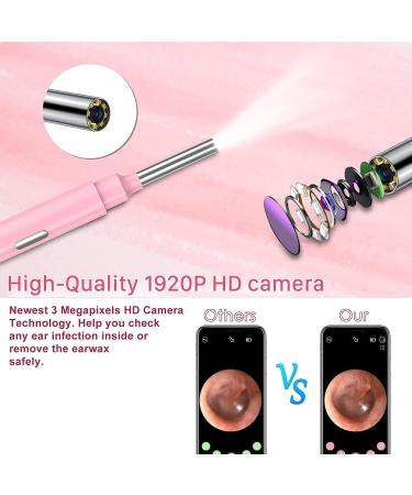 1920P FHD Wireless Ear Camera Otoscope with LED Lights - Ear Wax Remover Tool for iPhone, iPad & Android - Pink - Buy Online on GoSupps.com