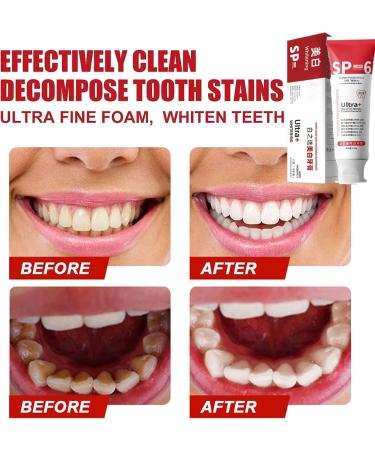 Sp-6 Ultra Whitening Toothpaste Upgraded Sp-4 Ultra Whitening Sp 6 Toothpaste Pasta De Dientes Sp-6 Sp 6 Ultra Whitening (3PCS) - Buy Online on GoSupps.com