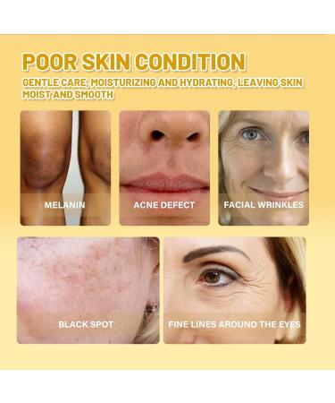 Turmeric Dark Spot Correcting Serum Niacinamide Serum Hydrating Serum Anti Aging Brightening Face Serum For Pure Skin Glow Face Serum Reduce Wrinkles Acne For Face Moisturizes Face Skincare - Buy Online on GoSupps.com