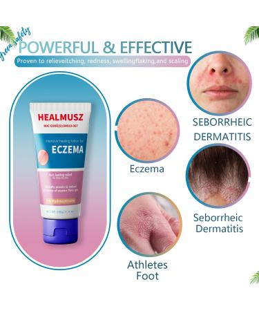 Eczema Cream for Adults - Fast Relief for Rash Psoriasis Dermatitis & Itch - Sensitive Skin Treatment (3.4 Fl Oz - Buy Online on GoSupps.com