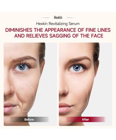 Hexkin Rejuvenating Face Serum Ampoule Set Daily Essence with Hyaluronic Acid & Antioxidants | Korean Skincare for Hydrating Firming and Radiance Boost (5 x 2ml) - Buy Online on GoSupps.com