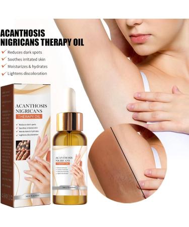 Black Spine Skin Repair Oil Moisturizes and Repairs Axillary Joints Arms Black Radiance Whitening Moisturizing and Beautifying Essential Oil (1 piece) - Buy Online on GoSupps.com
