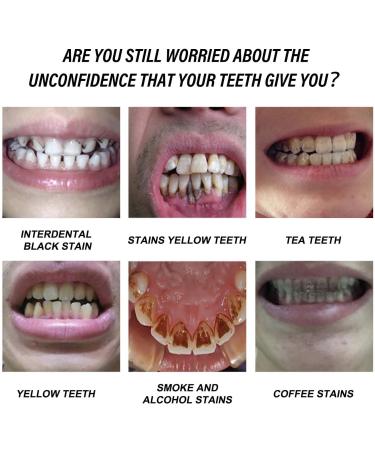 KLYso Advanced Teeth Whitening Toothpaste - Protect Gums Remove Stains Eliminate Bad Breath Safe for Enamel(2PCS) - Buy Online on GoSupps.com