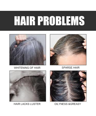 Savon anti-cheveux gris savon blanchissant naturel pour cheveux noirs hydratant nettoie en profondeur et fortifie le cuir chevelu 2pcs - Buy Online on GoSupps.com