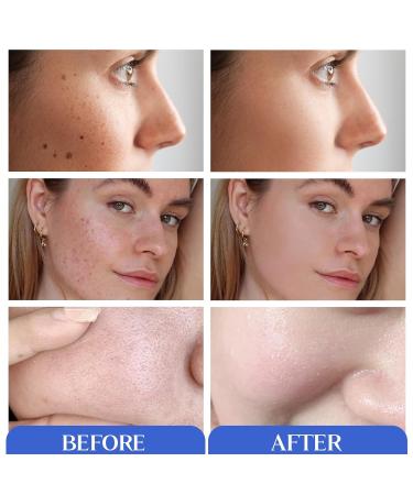 Glycolic Acid Peel Pads - 10% Glycolic & 2% Salicylic Acid Face & Body Cleansing Pads with Vitamins B3 C E Green Tea Calendula - 60 Count - Buy Online on GoSupps.com