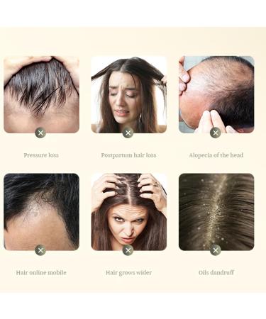 Shampoing Anti Chute Shampooing Anti-perte de Cheveux pour Femmes Feuchtigkeitsspendende Haarpflege f r Haarwachstum Hydratation & R paration Pour Cheveux Fragiles - Buy Online on GoSupps.com