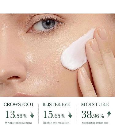 Tea Tree Acne Cream 50g - Spot Cream for Acne & Pimple - Dark Spot Remover for Face - Blackhead Remover Cream - Skin Care Face Cream for Women - Oil Control Soothing and Moisturizing Pimple Cream - Buy Online on GoSupps.com