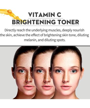 Vitamin C Toner Face Toner For Acne Vitamin C Face Serum Skincare Gifts for Teenage Girl Pore Minimizer Serum Brightening Niacinamide Serum for Anti Aging Reduce Dark Spots&Dullness Nourishing For Dry - Buy Online on GoSupps.com
